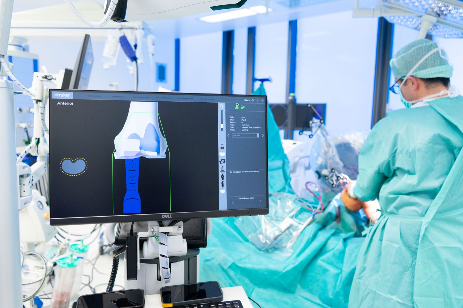 Beste Klinik Für Knie-op In Hannover Präzisere Knie-OPs dank hochmoderner Roboter-Technologie | MVZ
