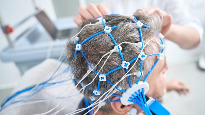 Messung der elektrischen Aktivität im Gehirn